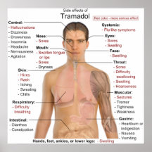 Side Effects Chart for Tramadol Hydrochloride Posters