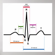 Sinus Rhythm in an Electrocardiogram ECG Diagram Print