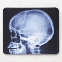 skull mousepad