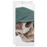 SkullBaseballCap032709 rack cards
