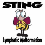 STING Lymphatic Malformation photo sculptures