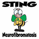 STING Neurofibromatosis photo sculptures