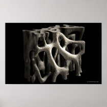 Structure of a bone with osteoporosis posters