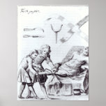 Surgical operation to amputate a leg posters