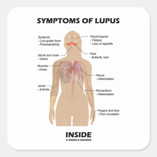Symptoms Of Lupus Inside (Autoimmune Disorder) Stickers