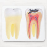 Teeth Anatomy mousepads