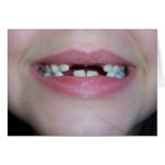 teeth cards