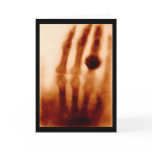The First X-Ray, 1901, Photograph