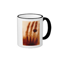 The First X-Ray, 1901, Photograph Mug