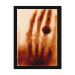 The First X-Ray, 1901, Photograph