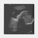Ultrasound Fridge Magnet