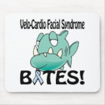 Velo-Cardio Facial Syndrome BITES mousepads