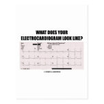 What Does Your Electrocardiogram Look Like? Postcards