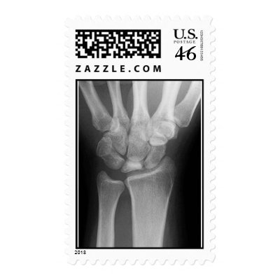wrist x-ray postage by jeffsdx