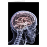X-Ray Brain Card