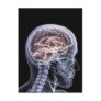 X-Ray Brain Postcard