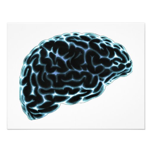 brain ray