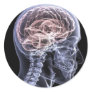 X-Ray Brain Stickers