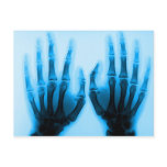 X Ray Eyes Post Card