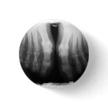 X-Ray Feet Human Skeleton Bones Black & White buttons