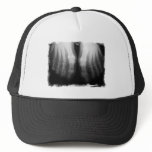 X-Ray Feet Human Skeleton Bones Black & White Trucker Hats