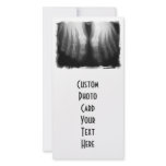 X-Ray Feet Human Skeleton Bones Black & White photo cards