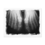 X-Ray Feet Human Skeleton Bones Black & White postcards