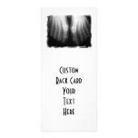 X-Ray Feet Human Skeleton Bones Black & White Custom Rack Card