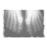 X-Ray Feet Human Skeleton Bones Black & White Customised Stationery