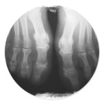 X-Ray Feet Human Skeleton Bones Black & White Round Stickers