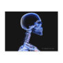 X-ray of the bones in the neck postcards