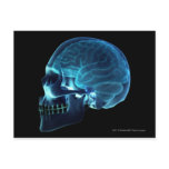 X-ray of the brain inside a skull postcards