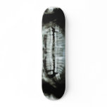 X-Ray skateboards