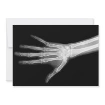 X-Ray Skeleton Arms Black & White