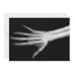 X-Ray Skeleton Arms Black & White invitations
