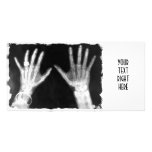 X-Ray Skeleton Hands & Jewellery - B&W photo cards