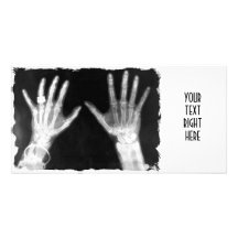 X-Ray Skeleton Hands & Jewellery - B&W Photo Greeting Card