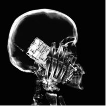 X-RAY SKELETON ON PHONE - B&W
