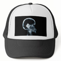 X-RAY SKELETON ON PHONE - BLUE