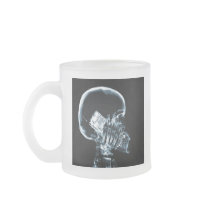 X-RAY SKELETON ON PHONE - BLUE COFFEE MUGS
