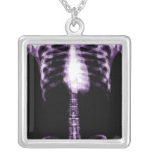 X-Ray Skeleton Ribs & Spine Necklaces