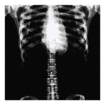 X-RAY SKELETON TORSO RIBS - B&W CUSTOM INVITES