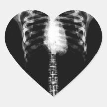 X-RAY SKELETON TORSO RIBS - B&W HEART STICKER