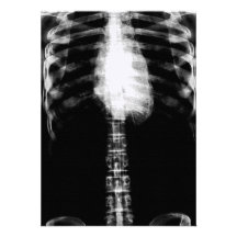 X-RAY SKELETON TORSO RIBS - B&W PERSONALISED ANNOUNCEMENT