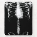 X-RAY SKELETON TORSO RIBS B&W mousepads