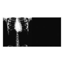X-RAY SKELETON TORSO RIBS - B&W PERSONALISED PHOTO CARD