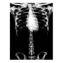 X-RAY SKELETON TORSO RIBS B&W POSTCARD