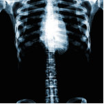 X-RAY SKELETON TORSO RIBS - BLUE ACRYLIC CUT OUTS
