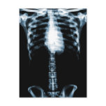 X-RAY SKELETON TORSO RIBS BLUE POSTCARD