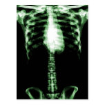 X-RAY SKELETON TORSO RIBS GREEN POST CARD